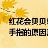 红花会贝贝剁手指是怎么回事 红花会贝贝剁手指的原因真相