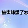 被蜜蜂蜇了怎么消肿 蜜蜂蛰消肿的最快方法