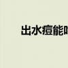 出水痘能吃什么 小儿出水痘食谱推荐