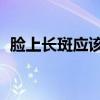 脸上长斑应该怎么做   如何改善长斑的问题
