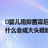 ​婴儿用抑菌霜后成大头娃娃是怎么回事  婴儿用抑菌霜后为什么会成大头娃娃