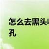 怎么去黑头收缩毛孔 四个小方法帮你缩小毛孔