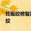 妊娠纹修复霜哪种好用 五款修复霜淡化妊娠纹