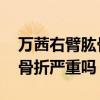 万茜右臂肱骨骨折是怎么回事 万茜右臂肱骨骨折严重吗
