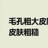 毛孔粗大皮肤粗糙怎么办 如何改善毛孔粗大皮肤粗糙