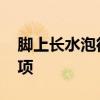 脚上长水泡很痒怎么办 脚上长水泡的注意事项
