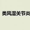 类风湿关节炎能彻底治好吗 怎么预防关节炎