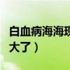 白血病海海现在情况怎样（海海白血病今年多大了）