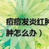 痘痘发炎红肿怎么办涂什么药膏（痘痘发炎红肿怎么办）