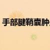 手部腱鞘囊肿最佳治疗方法（手部腱鞘囊肿）