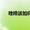 唑疮该如何治疗（唑疮怎么治疗除根）
