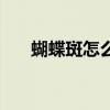 蝴蝶斑怎么能去掉（蝴蝶斑怎么消除）