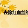 去除红血丝的小方法（去除红血丝的方法）
