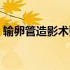 输卵管造影术要做多长时间（输卵管造影术）