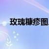 玫瑰糠疹图片大全大图（玫瑰糠疹图片）