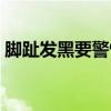 脚趾发黑要警惕四种病（脚指甲变黑怎么治）