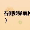 右侧卵巢囊肿症状是什么（右侧卵巢囊肿症状）