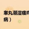 睾丸潮湿瘙痒是什么药膏（睾丸潮湿瘙痒啥毛病）