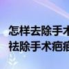怎样去除手术疤痕最有效的方法是什么（如何祛除手术疤痕）