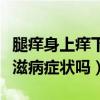 腿痒身上痒下面痒是不是艾滋病（大腿痒是艾滋病症状吗）