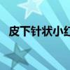 皮下针状小红点（皮下有针眼大的小红点）