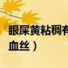 眼屎黄粘稠有红血丝怎么办（眼屎黄粘稠有红血丝）