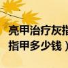 亮甲治疗灰指甲多少钱一个疗程（亮甲治疗灰指甲多少钱）