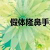 假体隆鼻手术推荐医院（假体隆鼻手术）