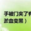 手被门夹了有淤血变黑怎么办（手被门夹了有淤血变黑）