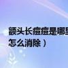 额头长痘痘是哪里的问题怎么调理（额头长痘痘是什么原因怎么消除）