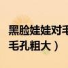 黑脸娃娃对毛孔粗大效果大吗（黑脸娃娃治疗毛孔粗大）