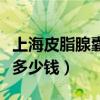 上海皮脂腺囊肿手术多少钱（皮脂腺囊肿手术多少钱）