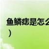 鱼鳞痣是怎么引起的（鱼鳞痣是怎么长出来的）