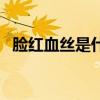 脸红血丝是什么原因引起来的（脸红血丝）