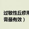 过敏性丘疹用什么药膏最有效（丘疹用什么药膏最有效）