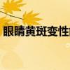 眼睛黄斑变性能治好吗（黄斑变性能治好吗）
