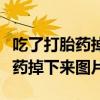 吃了打胎药掉下来的是什么样子的（吃完打胎药掉下来图片）
