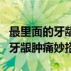 最里面的牙龈肿痛怎么办吃什么药（最里面的牙龈肿痛妙招）