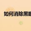 如何消除黑眼圈小方法（如何消除黑眼圈）