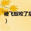 被飞蚁咬了后会怎么办（被飞蚁咬了后有毒吗）