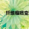 纤维瘤癌变能活多久（纤维瘤癌变几率）