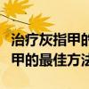 治疗灰指甲的最佳方法什么药店买（治疗灰指甲的最佳方法）