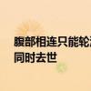 腹部相连只能轮流睡觉：世界最长寿男性连体双胞胎 68岁同时去世