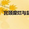宫颈糜烂与盆腔炎治疗仪（盆腔炎治疗仪）