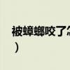 被蟑螂咬了怎么办?知乎（被蟑螂咬了怎么办）