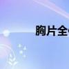 胸片全体曝光（女人脱光衣服）