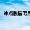 冰点脱唇毛后多久可以碰水（冰点脱唇毛）