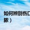 如何辨别伤口是否化脓（如何判断伤口是否化脓）