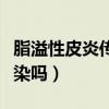 脂溢性皮炎传染吗传染他人吗（脂溢性皮炎传染吗）