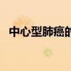 中心型肺癌的结局（中心型肺癌死前症状）